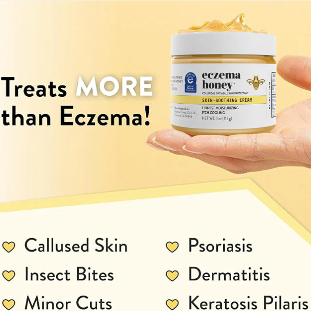 Heal Eczema Itch in 7 Days, Protect for Life. Dermatologist-Backed. Trusted by 50,000+ Parents - Florivue Honey Ezcema Cream