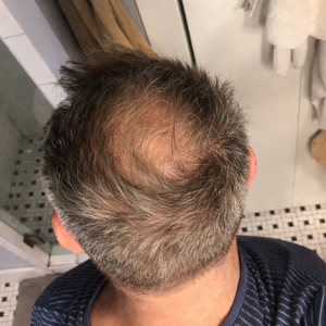 Billy B review image