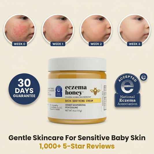 Heal Eczema Itch in 7 Days, Protect for Life. Dermatologist-Backed. Trusted by 50,000+ Parents - Florivue Honey Ezcema Cream